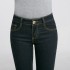 Don’t be a fashion victim: How wearing too-tight jeans may land you in the hospital